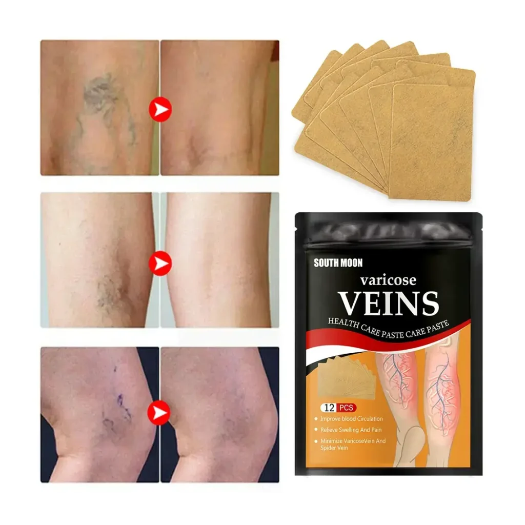 VaricOFF™ - Pack 24 Parches Para Varices